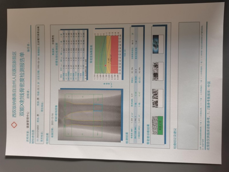 雙能X射線骨密度儀報(bào)告單